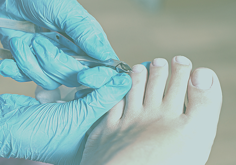 foot getting nails cut by podiatrist